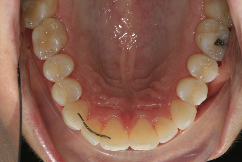 3 Barker Dental Care