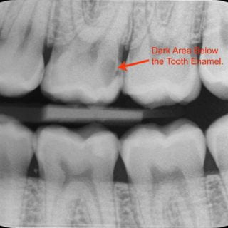 CI2 Decay