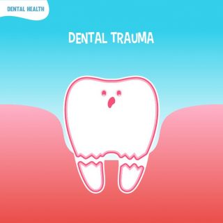 Dental Trauma Image